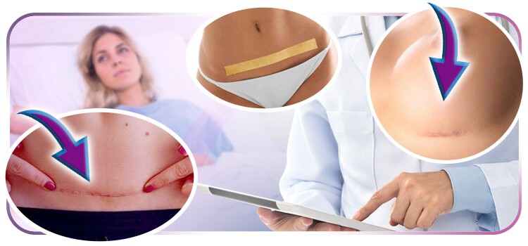 Tratamentos que são referência em cicatrização pós-cirúrgica